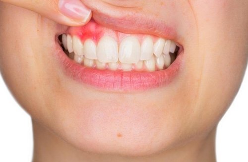 8. Periodontoloji Periodontoloji